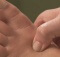 acupressure for weight loss