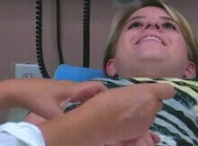 acupuncture demonstration