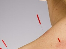 acupuncture can reverse nerve damage