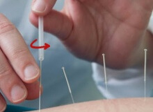 why acupuncture kills pain