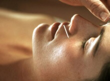 great reasons to try acupuncture