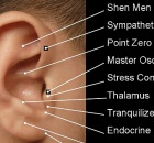 ear auricular acupuncture substance abuse