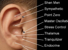 ear auricular acupuncture substance abuse