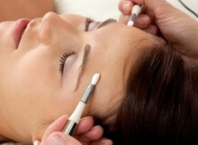 electroacupuncture treatment