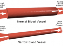 acupuncture can help lower high blood pressure