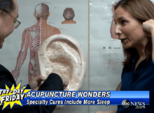 abc news how acupuncture helps with insomnia and sleeplessness